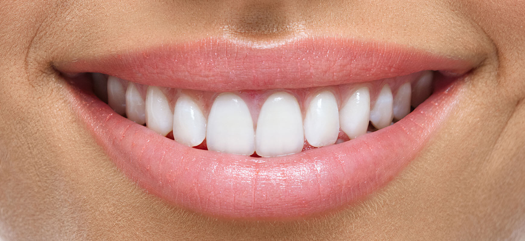 Белые здоровые зубы до и после. Красивые ровные белые зубы. Зубы должны быть белыми. Зубы должны быть белыми. Белые здоровые зубы до и после.